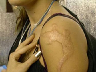 Вредны ли татуировки для здоровья